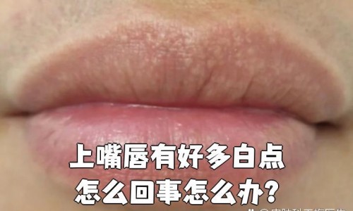 刷完酸期间可以化妆吗女生-【刷完酸能化妆吗】刷完酸可以洗澡吗 - 刷完酸期间可以化妆吗网